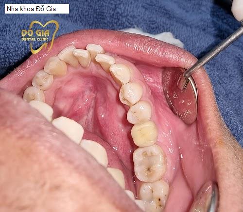 Hình ảnh Nha khoa Đỗ Gia